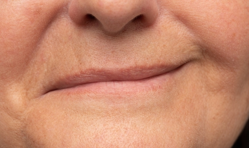understanding the causes of facial weakness a comprehensive guide